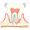 中度の歯周病