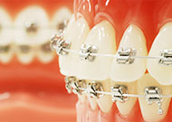 矯正歯科は矯正を専門に行う歯科医師が担当