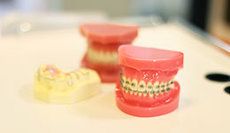 様々な歯並び改善方法に対応